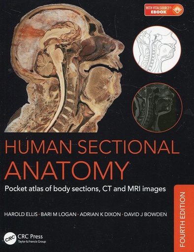 Human sectional anatomy