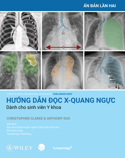 Hướng dẫn đọc X-quang ngực dành cho sinh viên Y khoa 144p 2E