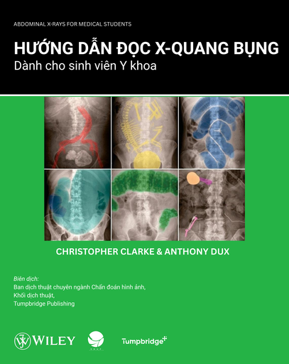Hướng dẫn đọc X-quang bụng dành cho sinh viên Y khoa 144p 2E
